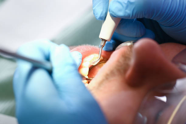 Best Tooth Infection Emergency Dentist  in Chelan, WA