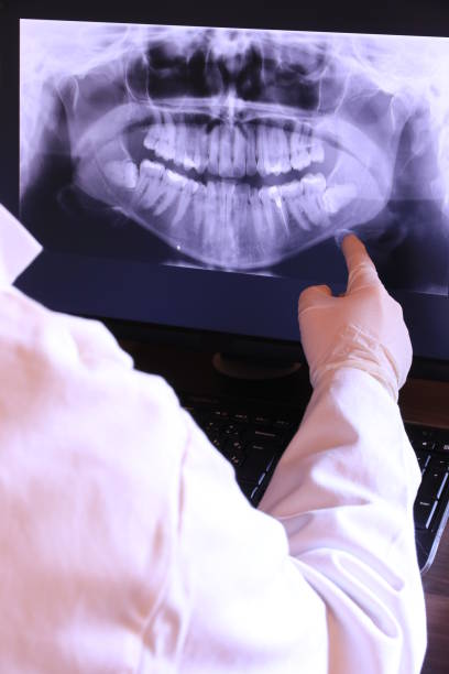 Best Broken Tooth Emergency  in Chelan, WA