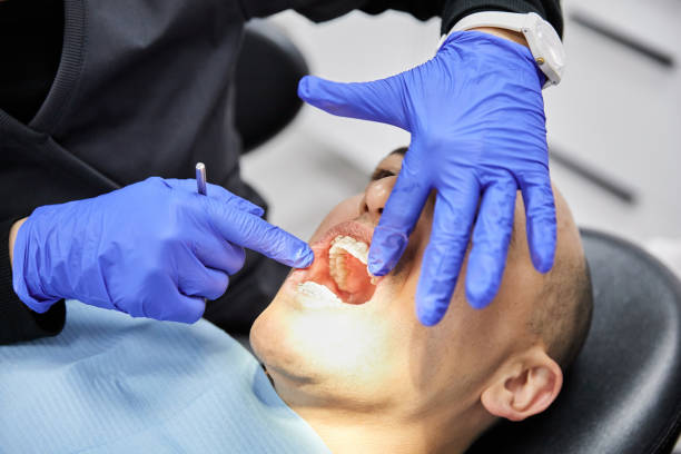Best Teeth Whitening  in Chelan, WA